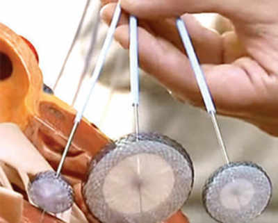 Bolivian women knit special ‘heart plugs’ for kids born with defects