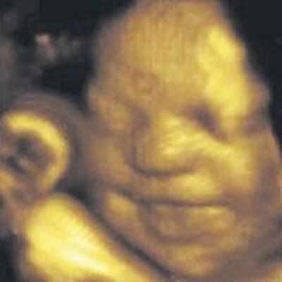 Foetus can smile at 26 weeks