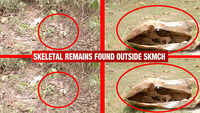 Bihar: Hundreds of skeletal remains found behind Sri Krishna Medical College and Hospital in Muzaffarpur 