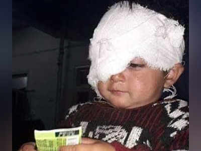 18-month-old pellet victim gets Rs 1L aid