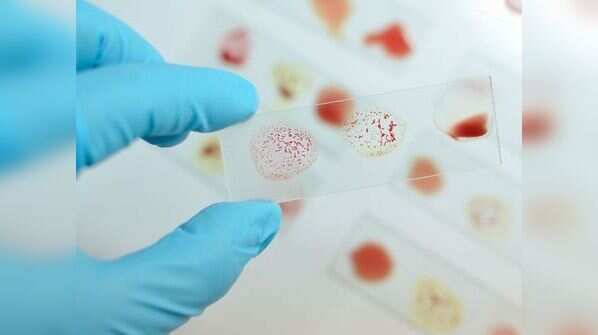 Coronavirus: Blood type O has lower COVID contraction risk and organ ...