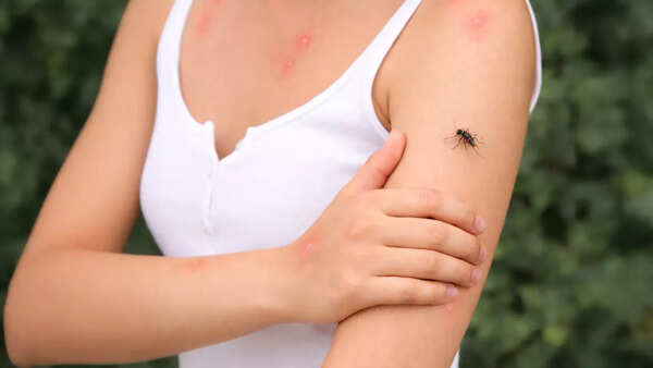 Can immune system of camels give us a new, powerful dengue antidote?