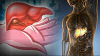 Hepatitis Day: Here are some general precautions that can save you 
