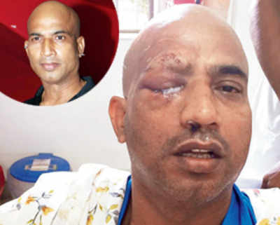 Actor Jeetu Verma attacked in Chittorgarh; could lose an eye
