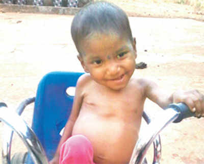 No end in sight to Palghar’s malnutrition crisis