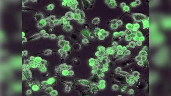 Can This Deadly Virus Kill Cancer Scientists Experiments