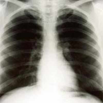 Monroe chest X-rays sell for $45,000