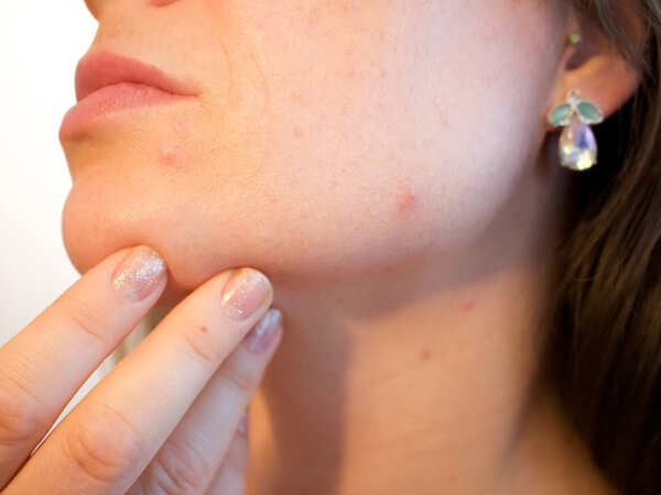 Know your doctor: Skin specialist