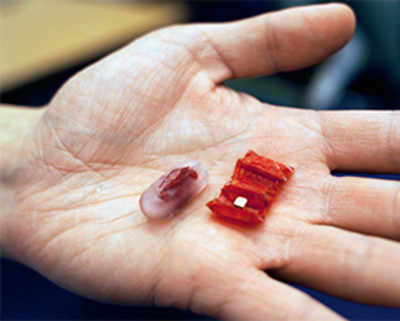 Ingestible robot to help treat internal wounds