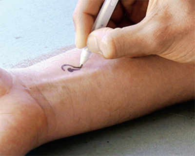High-tech ink could detect blood glucose