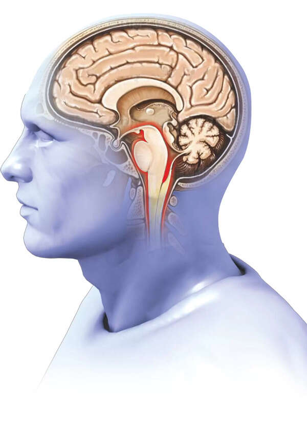 Amoebic brain infection: Kerala to conduct research
