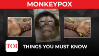 Monkeypox: Why gay men are at higher risk 
