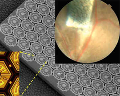 Photovoltaic retinal implant could restore functional sight