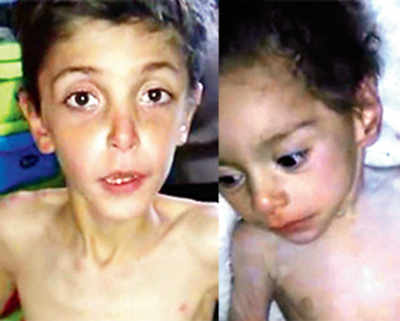 Chilling video shows starving Syrian kids