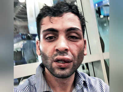 Booked for manhandling and obstructing cops, British-Indian accuses them of beating him up badly