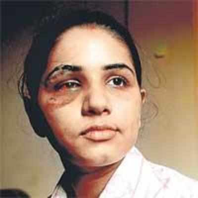 Dug-up road costs woman right eye