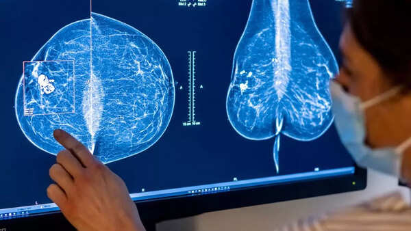 Mobile apps to expand breast cancer outreach and care launched in Kolkata