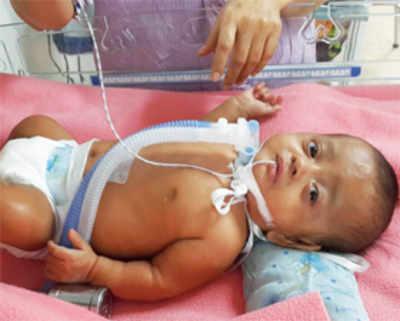Premature baby struggles for life for seven months