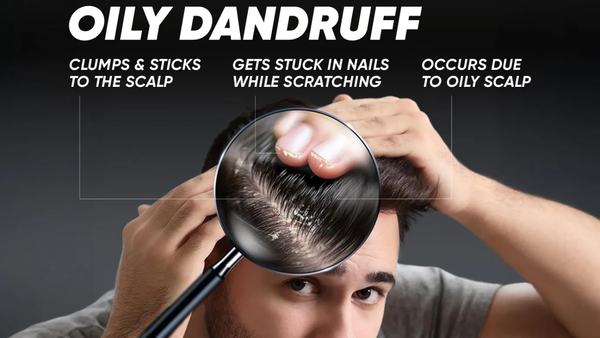 Oily & Sticky Scalp? Here's Why the Right Shampoo Matters