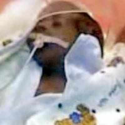 Twin of dead girl child not doing well