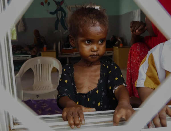 22.1% of state kids under 5 years suffer from acute malnutrition: NFHS-6