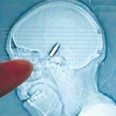 Grandma's headache turns out to be a bullet in the head