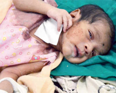 Miracle baby rescued off rly tracks in Kalyan
