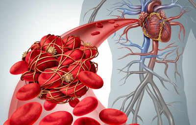 New method to predict blood clot risk in heart patients