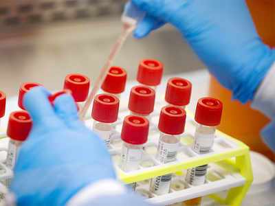 Private labs ask Centre to help them provide free tests