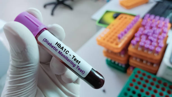 Why a ‘normal’ HbA1c may not mean you’re safe from diabetes