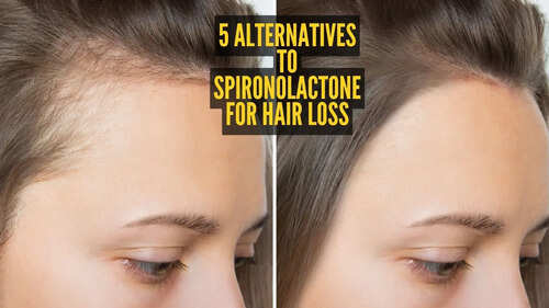 5 alternatives to Spironolactone to reverse hair loss