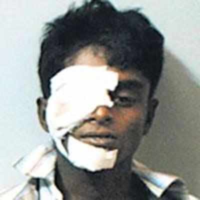 Blast victim loses eye for want of Rs 5,000