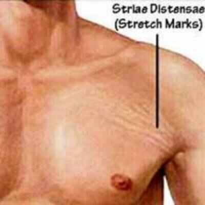 do spread out marks figure to come otherwise once credence loss