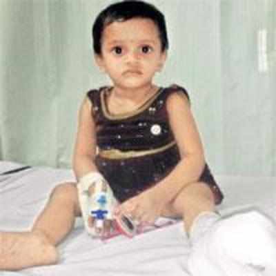 Cutter falls on Malad toddler, slices off toes