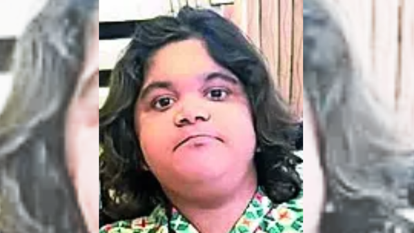 Unfazed by rare disorder, Jai Hind student scores in Arts, eyes career in animation