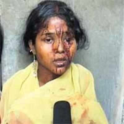 Woman beaten up at Turbhe police station rushes straight to court