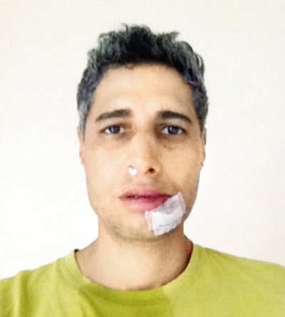 Bandra man gets a broken nose for calling out litterbugs