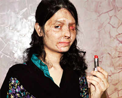 Girl, 18, is face of global drive against acid sale