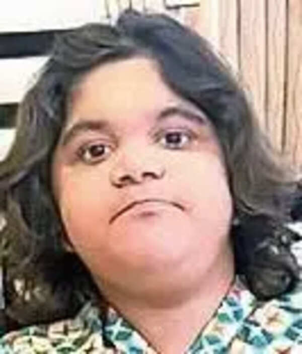 Unfazed by rare disorder, Jai Hind student scores in Arts, eyes career in animation