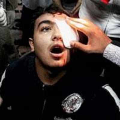 Eye hunter: Sniper cop in Egypt shot at protestors' eyes