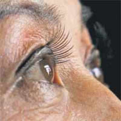 Eye donations crossed 5k mark in 2008