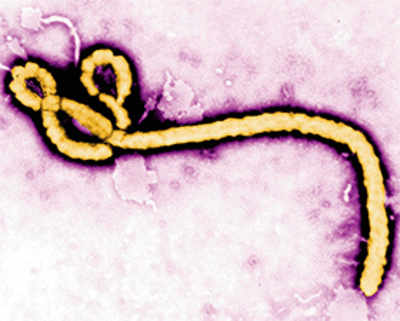Ebola virus’s Achilles’ heel can curb infections