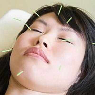 Acupuncture can cure women's disorders