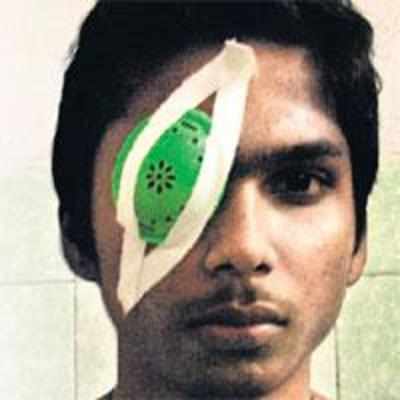 16-yr-old stabs mate in the eye