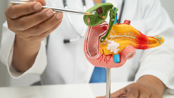Most people miss the signs until it’s too late: What makes pancreatic cancer so difficult to detect