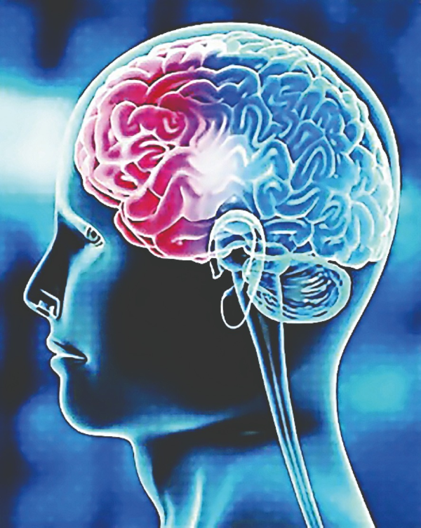 Affordable Supernova Stent: A Breakthrough in Stroke Treatment from India