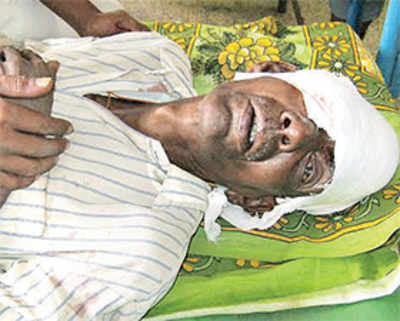 Man assaulted for thwarting daughter’s rape loses eye