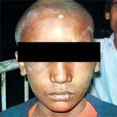 Another teen alleges torture at Mankhurd Children's Home