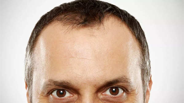 Personality traits of people who have broad forehead