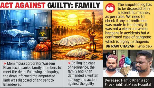 Amputated leg disposed of by hosp before handing over body for burial, family fumes